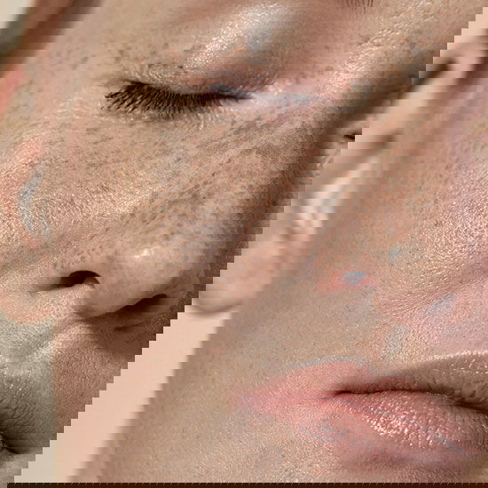 Grossaufnahme des Gesichts eine Frau mit Sommersprossen
